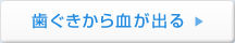 歯ぐきから血が出る